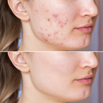 Amor Pigma-Light Dark Spot Correcting Essence Serum – Alpha Arbutin + Pea Extracts – Fade The Look Of Spots, Dark Spot Care & Tone Correction – Lightweight, Fast-Absorbing – For Post-Acne Marks, Pigmentation & Uneven Tone