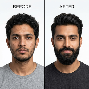 Dr. Alies Professional Beard Growth Oil | Fill Patchy Beard, Stop Itching & Dandruff – Natural 30ml