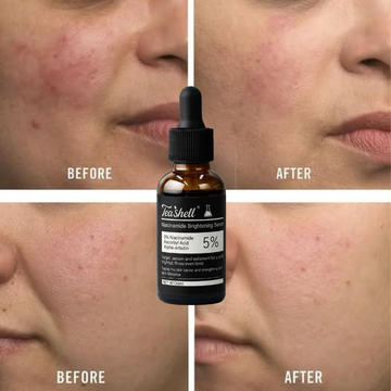 Teashell Niacinamide Brightening Serum | 5% Niacinamide + Alpha-Arbutin + Ascorbyl Acid | Fades Dark Spots, Evens Skin Tone & Boosts Glow