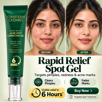 Conscious Chemist Rapid Relief Acne Spot Corrector Gel – Clears Pimples & Fades Dark Marks in 6 Hours