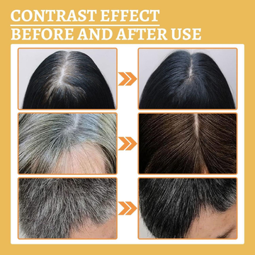 Proskire Anti-Grey Hair Serum – Prevents & Reverses Grey Hair, Reduces White Hair, Darkens & Revitalizes Hair Color – Controls Hair Fall